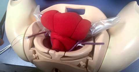 Pruebas invasivas (amniocentesis + biopsia corial)